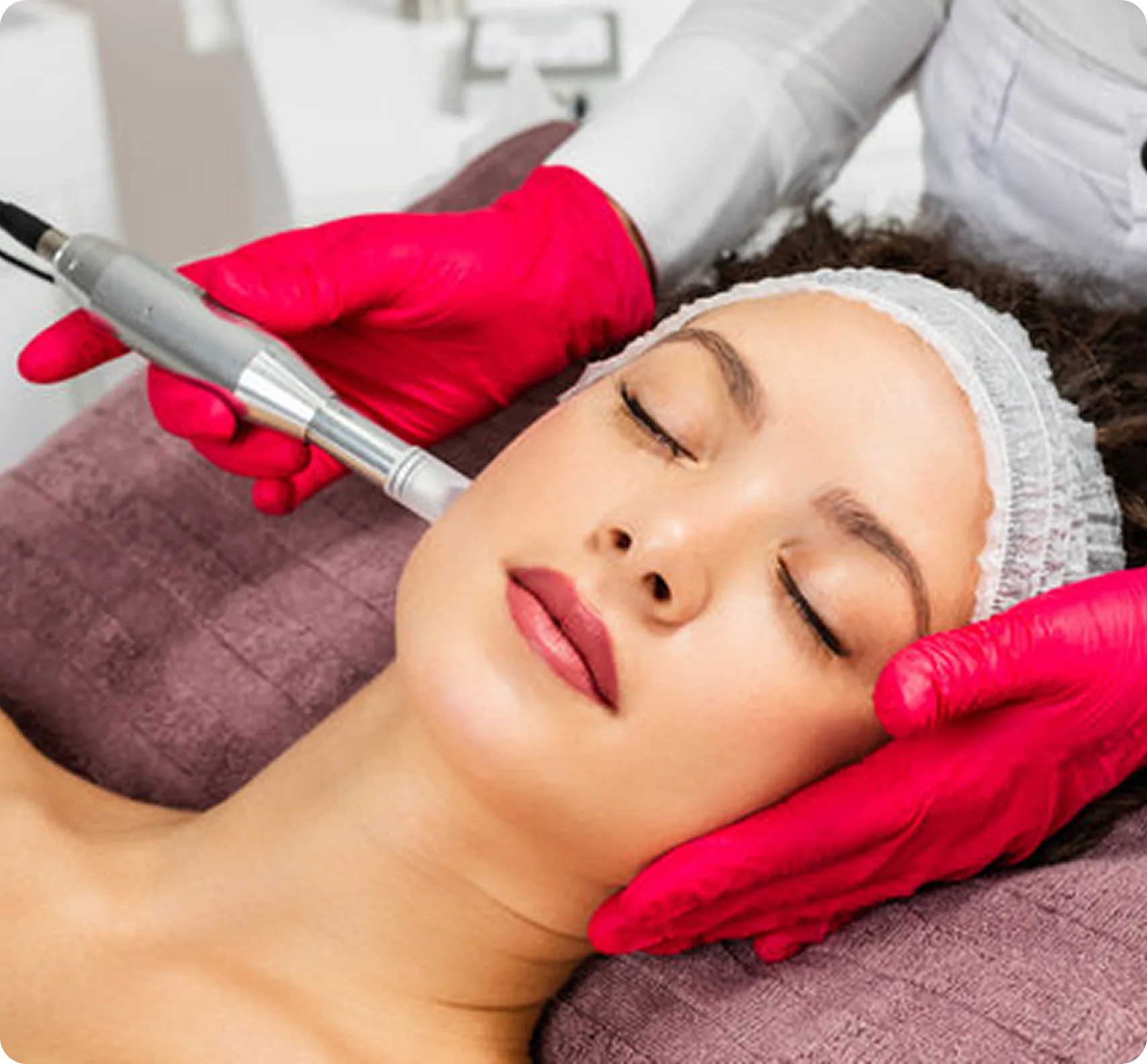 Microneedling Treatment